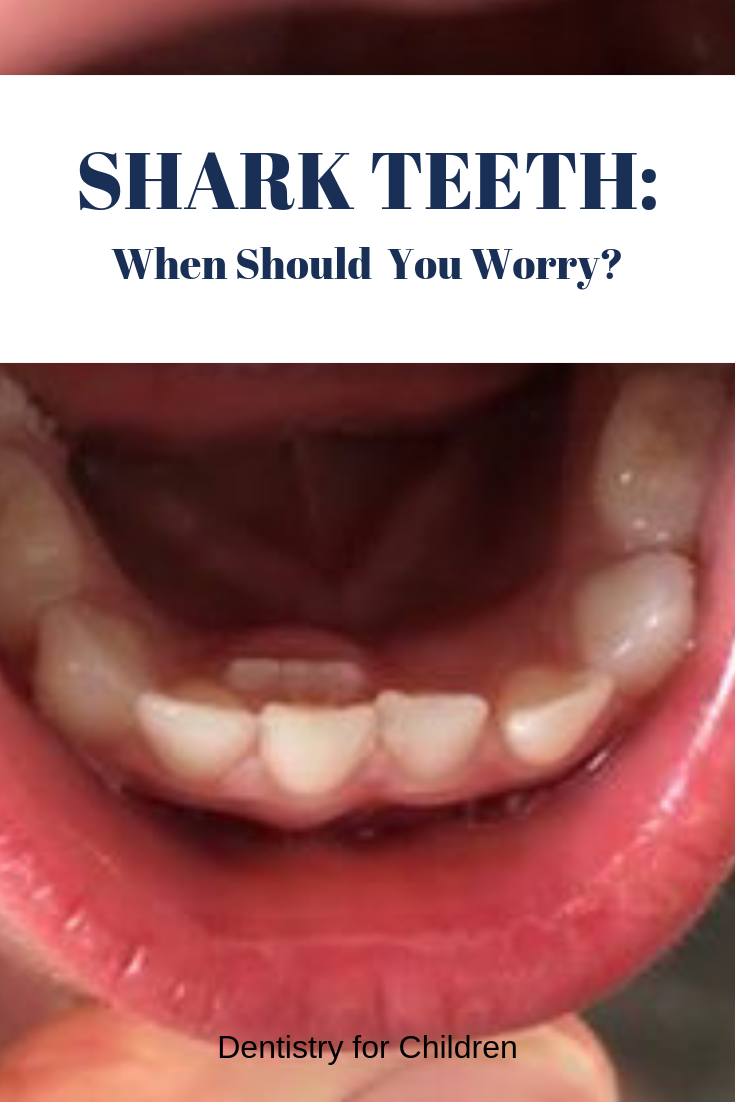 How long does it take for a tooth to grow Shark Teeth When Should You Worry