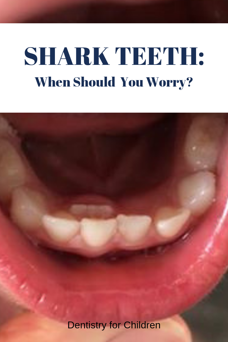 do you lose your canine teeth