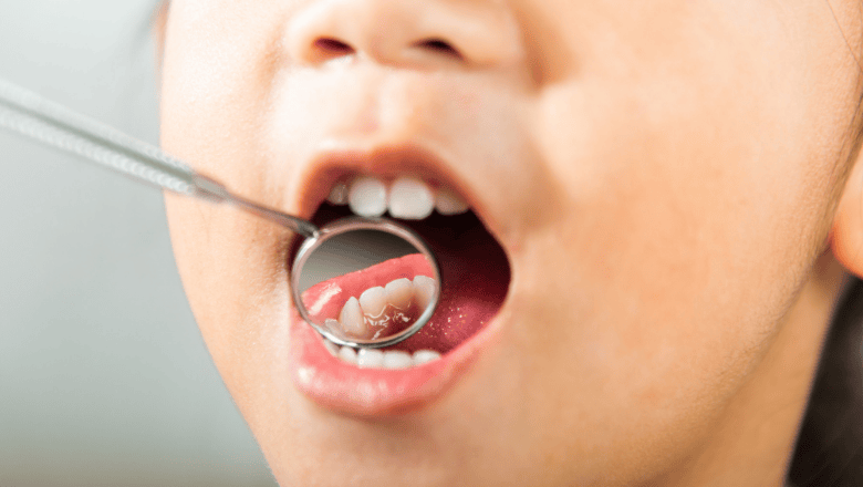 4 Dental Concerns Parents of Special Needs Children Should Know